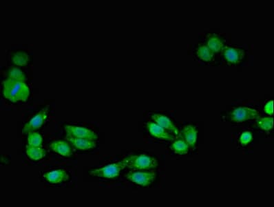 SMC4 Antibody