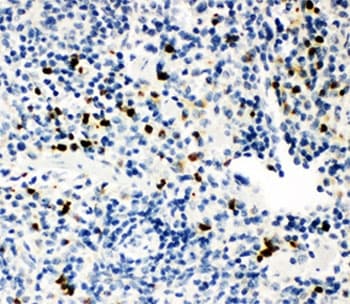 MPO / Myeloperoxidase Antibody (aa406-745)