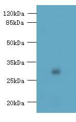 Polyclonal Rabbit anti-Human TMEM176B / LR8 Antibody (IHC, WB)