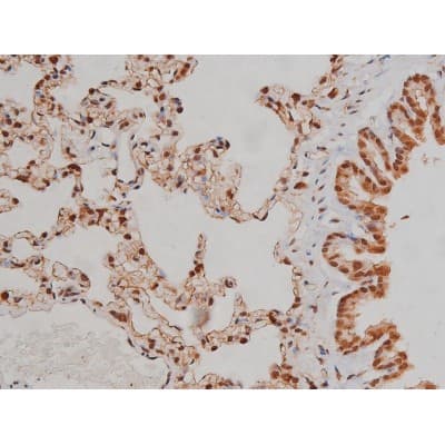 IGF1R / IGF1 Receptor Antibody (phospho-Tyr1346)