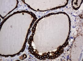 Monoclonal Mouse anti-Human POGK Antibody (clone OTI3E2, IHC, WB)