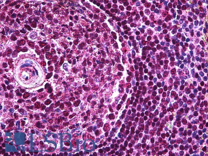 IHC-plus™ Monoclonal Mouse anti-Human PAX5 Antibody (clone 8F9, IHC, WB)
