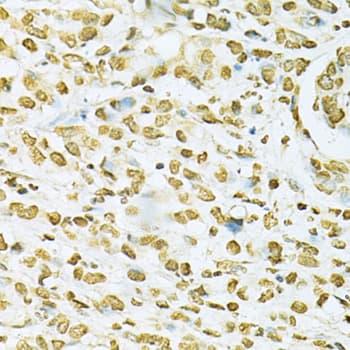 HNRNPA2B1 Antibody