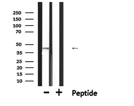 SERPINB5 / Maspin Antibody