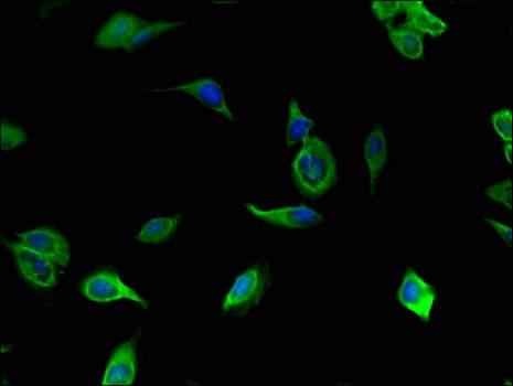 Polyclonal Rabbit anti-Human TLL1 Antibody (IHC, IF)