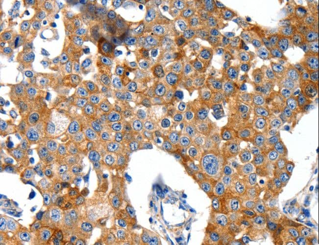 Polyclonal Rabbit anti-Human GRIA2 / GLUR2 Antibody (IHC)