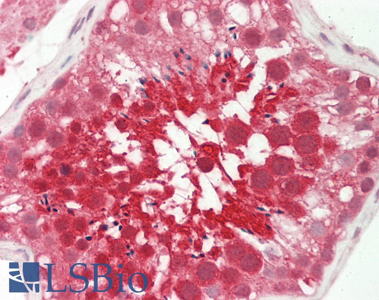 IHC-plus™ KMT2D / MLL2 Antibody (clone 2E1)