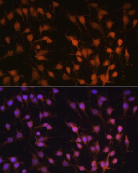 SIRT1 / Sirtuin 1 Antibody