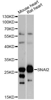 Polyclonal Rabbit anti-Human SNAI2 / SLUG Antibody (IHC, IF, WB)
