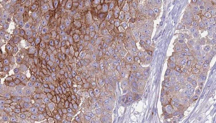 Polyclonal Rabbit anti-Human CD151 Antibody (IHC, IF, WB)