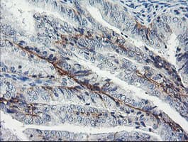 DTNB / Dystrobrevin Beta Antibody (clone OTI3A12)