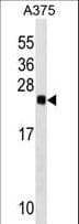 RAB2B Antibody (aa105-131)