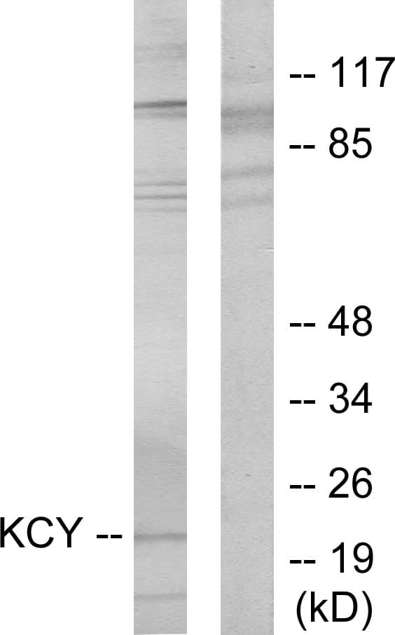 CMPK / CMPK1 Antibody (aa1-50)