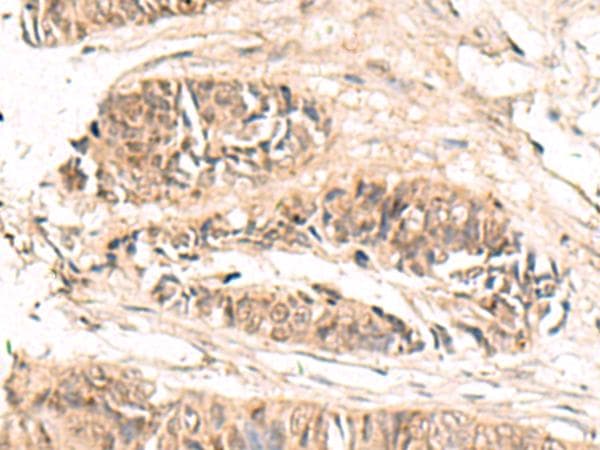 ABCB4 / MDR3 Antibody