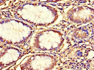Polyclonal Rabbit anti-Human C12orf65 Antibody (IHC)