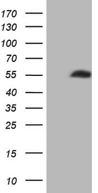 NOB1 / NOB1P Antibody (aa2-234, clone OTI1C12, Carrier-free)