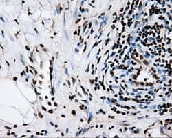 RPA2 / RFA2 / RPA34 Antibody (clone OTI9A1)