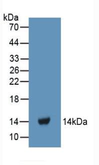 FGA / Fibrinogen Alpha Antibody (aa124-214)