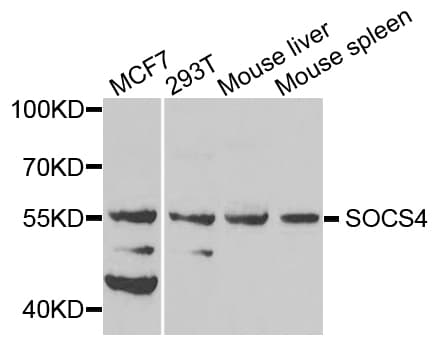 SOCS4 Antibody