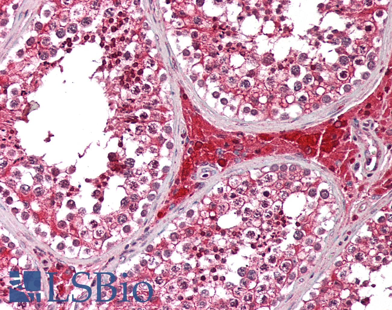 IHC-plus™ Polyclonal Rabbit anti-Human HBXIP Antibody (IHC, WB)