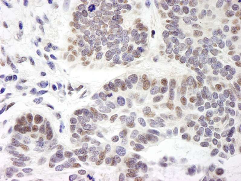Polyclonal Rabbit anti-Human ZMYM3 Antibody (aa250-300, IHC, WB)