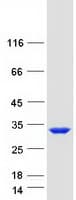 Human TPPP Protein (Recombinant Myc-DDK (Flag))