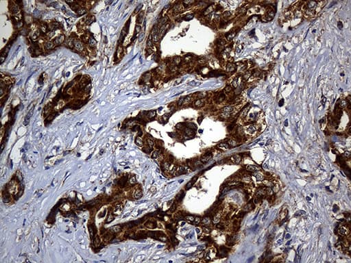 ALDH7A1 Antibody (clone OTI1A9, Carrier-free)