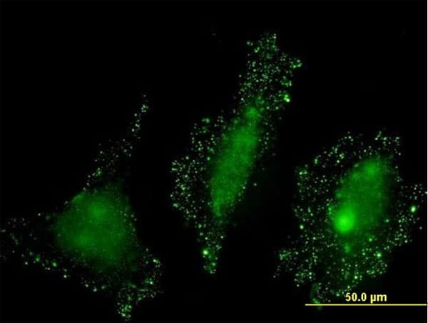 Monoclonal Mouse anti-Human PKN2 Antibody (clone 3A7, IF, WB)