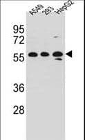 Polyclonal Rabbit anti-Human TRIM4 / RNF87 Antibody (aa112-141, IHC, WB)