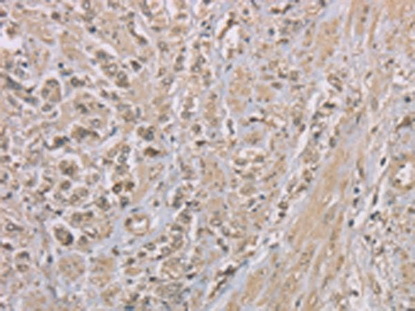 ZBTB2 Antibody
