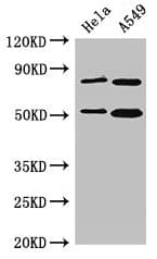 Polyclonal Rabbit anti-Human SNX27 Antibody (IHC, WB)