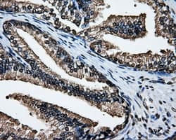 SORD / Sorbitol Dehydrogenase Antibody (clone OTI15H2)