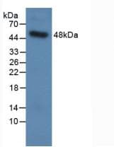 SFTPC / Surfactant Protein C Antibody (aa24-197, PE)