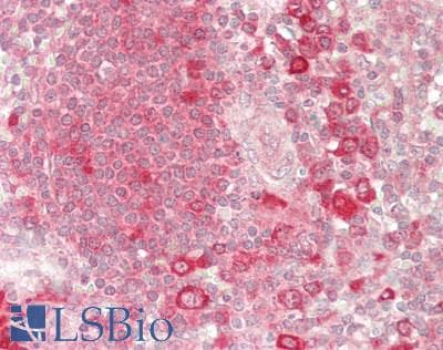 IHC-plus™ AARS Antibody (aa275-325)