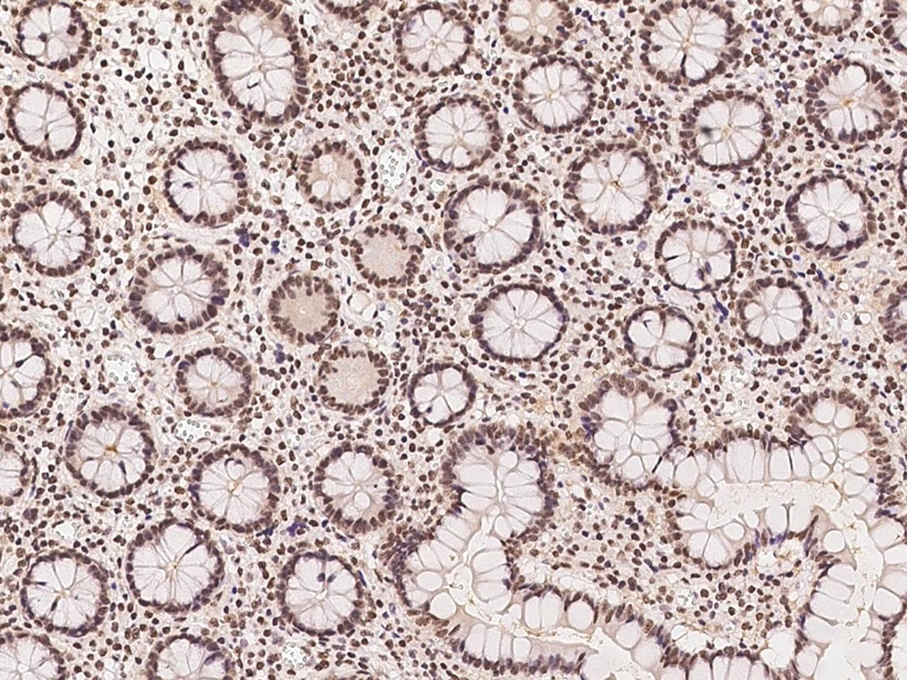 THOC3 Antibody