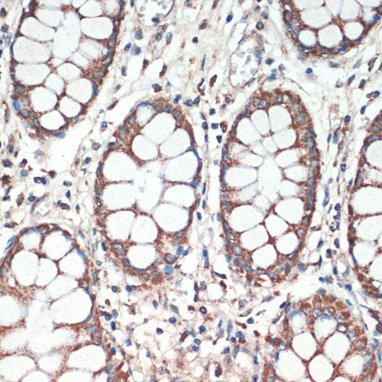 APC Antibody