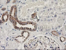 BCAR1 / p130Cas Antibody (clone OTI1B1)
