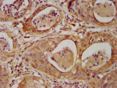 DHX34 Antibody
