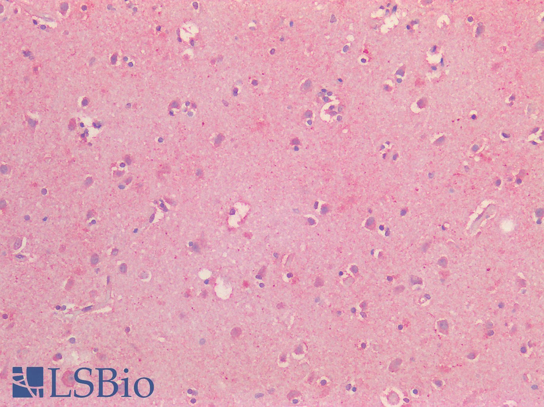 PathPlus™ NOS1 / nNOS Antibody (aa1457-1468)