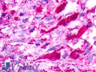PathPlus™ Polyclonal Rabbit anti-Human NMUR1 Antibody (Cytoplasmic Domain, IHC)