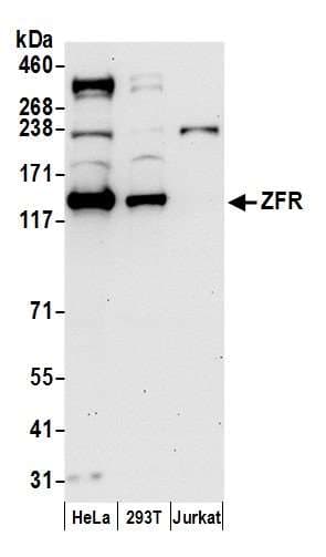 ZFR Antibody (aa1-50)