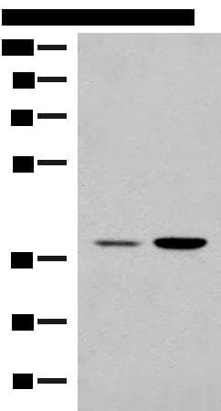 Polyclonal Rabbit anti-Human MRM1 Antibody (IHC, WB)