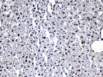 FLT4 / VEGFR3 Antibody
