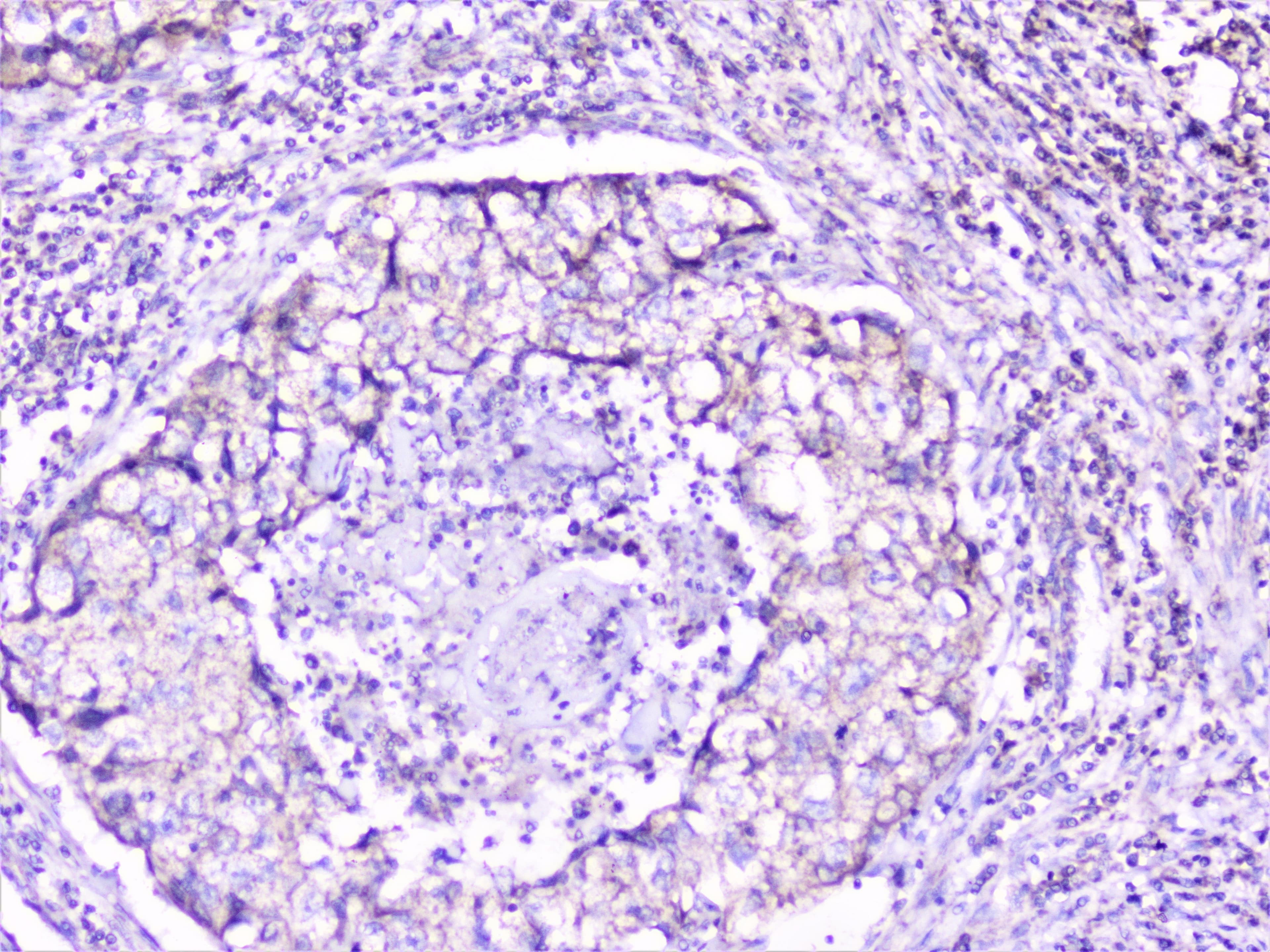 CTTN / Cortactin Antibody