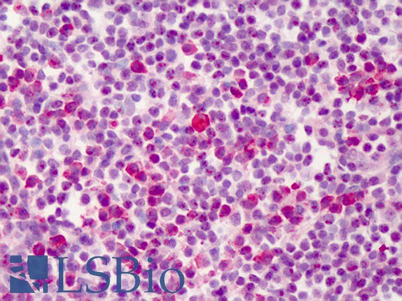 IHC-plus™ Polyclonal Rabbit anti-Human BCL2L1 / BCL-XL Antibody (IHC, WB)