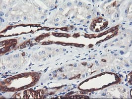 PFKP Antibody (clone OTI2E10)