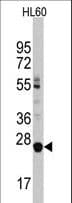Polyclonal Rabbit anti-Human LIN28B Antibody (aa218-250, WB)