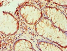 LP-PLA2 / PLA2G7 Antibody (clone 2A1B6)