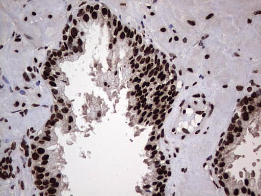 HNRNPL / hnRNP L Antibody (aa270-502, clone OTI9F11, Carrier-free)