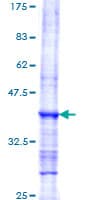 Human MPO / Myeloperoxidase Protein (Recombinant GST, N-terminus)